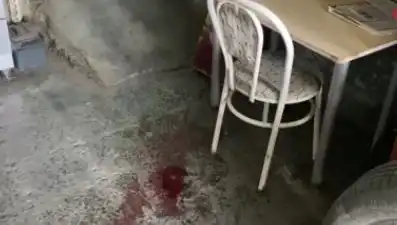 Dikkatsizlik Sonucu Sandalyeden Düşen Adam Ağır Yaralandı