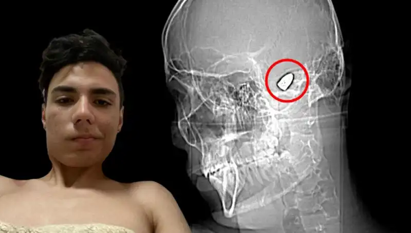 Kafasında Patlayıcı ile Yaşayanlar: Zihin Sağlığı Üzerine Derinlemesine İnceleme