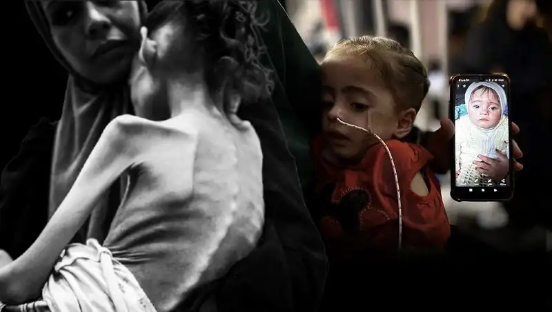 Meryem'in Hikayesi: 25 Kilodan 10 Kiloya Düşen Minik Kız Açlıkla Mücadele Ediyor